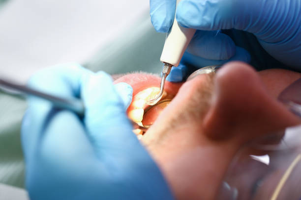 Best Emergency Treatment for Toothache in Westbrook, ME