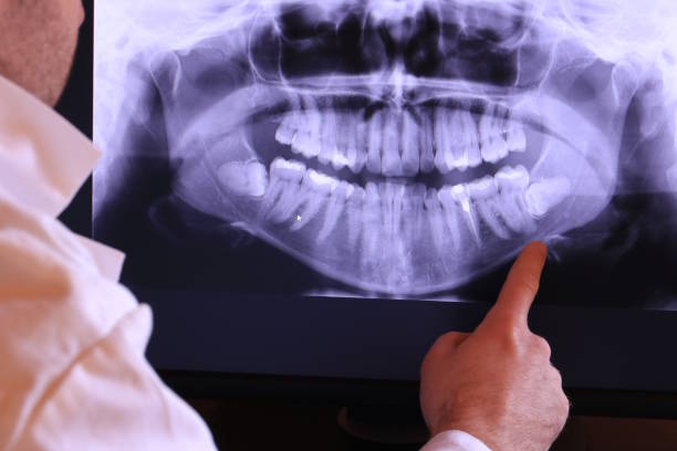 Best Emergency Tooth Extraction in Westbrook, ME